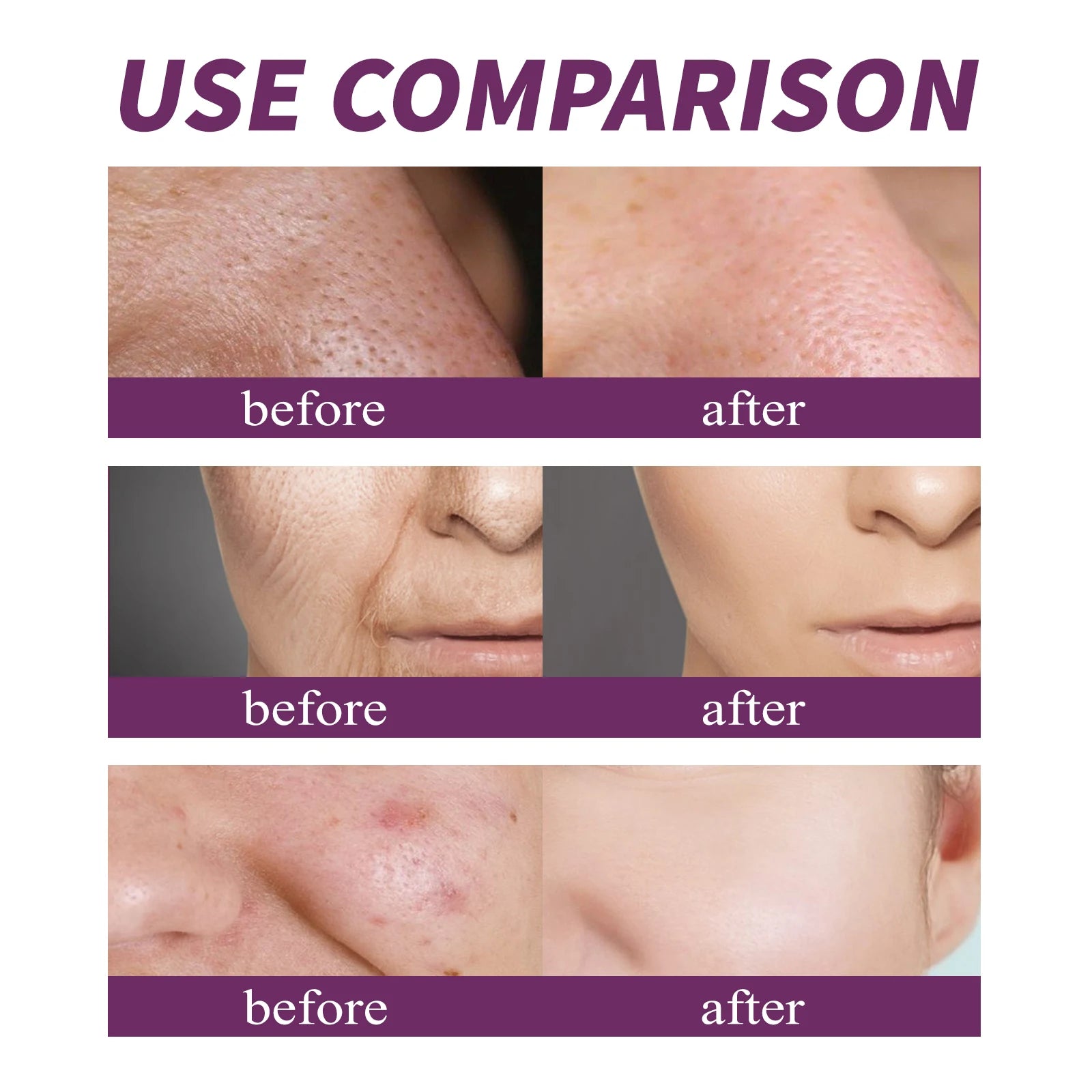 Concentrado antiedad con 20 % de niacinamida B3 para combatir la decoloración y minimizar los poros dilatados. Sin perfume ni parabenos. 20 ml.